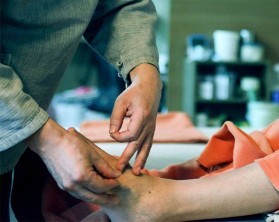 Acupuncture on the foot in the wellness hotel